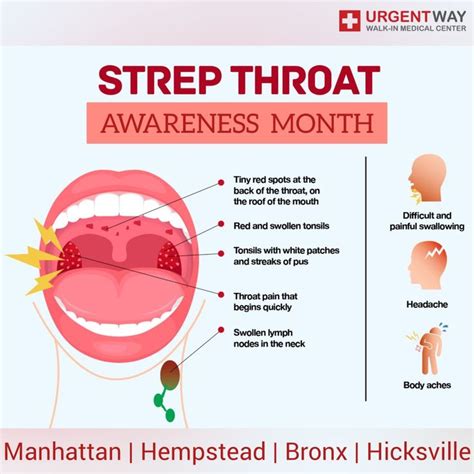 strep throat 3 month old