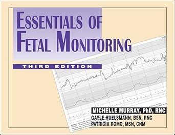 Buy Essentials of Fetal Monitoring Book Online at Low Prices in India ...