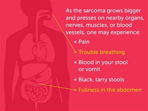 Signs and Symptoms of Soft Tissue Sarcomas | Dana-Farber Cancer Institute