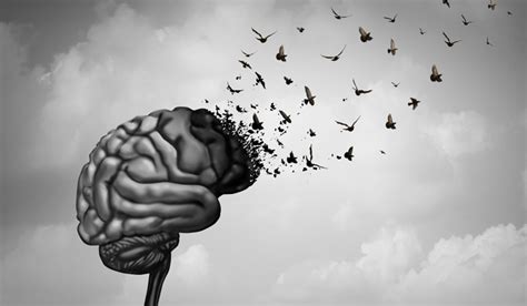 New type of dementia that mimics Alzheimer's identified- The Week