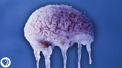 What Kind Of Pain Is Brain Freeze at James Mcmahan blog