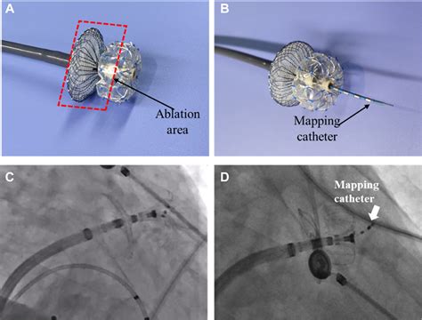 Simultaneous Pulsed Field Ablation and Mechanical Closure of Left ...