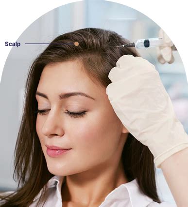 PRP Treatment in Ahmedabad, PRP Treatment Ahmedabad, PRP Hair Treatment ...