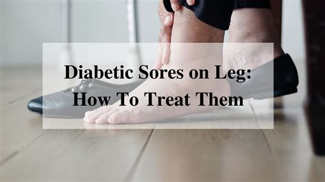 Diabetic Sores on Legs: Causes, Diagnosis, and Prevention Tips