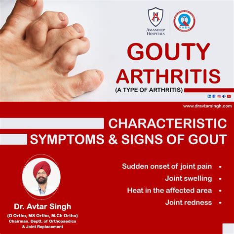 Not every knee pain is arthritis – Artofit