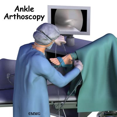 Ankle Arthroscopy | eOrthopod.com