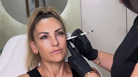 REJURAN Perth - 'Salmon Sperm Facial' - Face and Body Inc