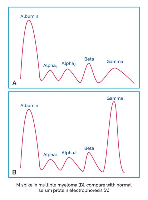 Protein Electrophoresis Mspike