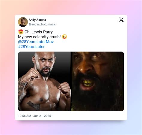 Chi Lewis-Parry Bares It All in '28 Years Later' — Prosthetic and All ...