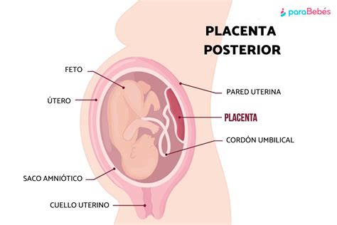 Placenta posterior: qué es, consecuencias y cómo prevenirla