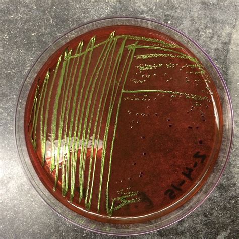 EOSIN METHYLENE BLUE (EMB) AGAR - Microbiology Lab Notes