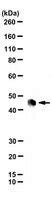 Anti-Rabies Virus Phosphoprotein Antibody, clone M974 | MABF3148-100UG