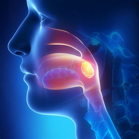 To Have Your Tonsils Removed - Learn How to Sign