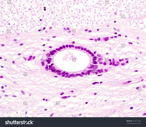 Central Ependymal Canal Spinal Cord Lined Stock Photo 762415636 ...