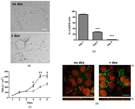 Magnetofection Enhances Lentiviral-Mediated Transduction of Airway ...