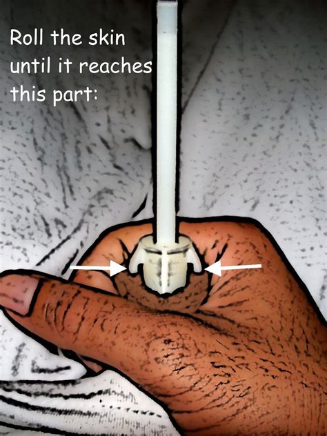 Is Pulling Back Foreskin Necessary