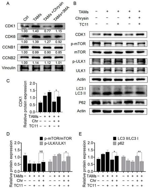Chrysin Inhibits TAMs-Mediated Autophagy Activation via CDK1/ULK1 ...