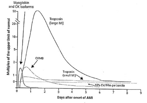 Acute Myocardial Infarction-Clinical features - Medical Science ...