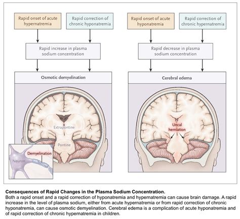 Hyponatremia Algorithm 的图像结果