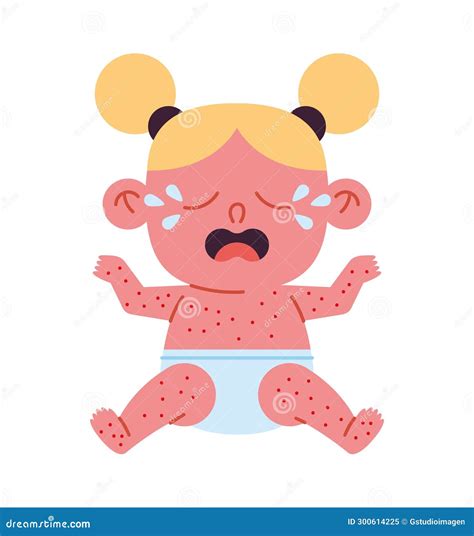 Enfermedad De Kawasaki En Una Niña Stock de ilustración - Ilustración de inmune, intravenoso ...