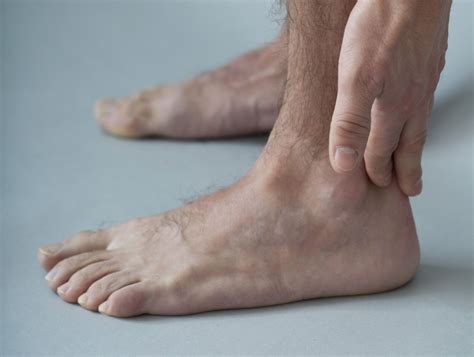 Tendonitis of the Foot and Ankle