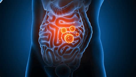 6 Worst Foods to Avoid for Gut Health – thegoodbug