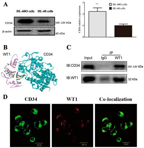 Shikonin as a WT1 Inhibitor Promotes Promyeloid Leukemia Cell ...