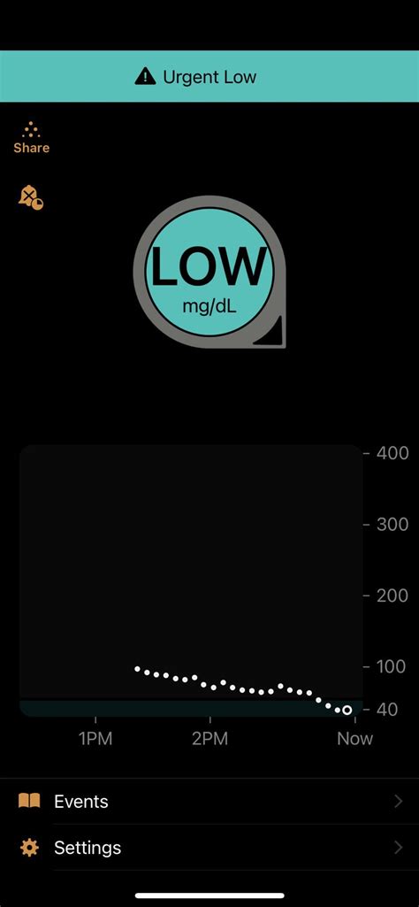 Image result for Dexcom Update