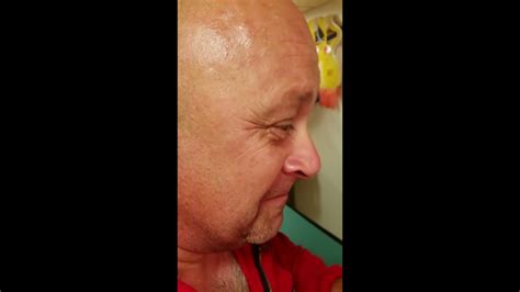 Largest Exploding Cyst 的图像结果