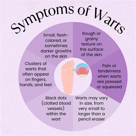 Warts: Causes, Risk Factors, Symptoms, Treatment