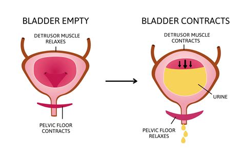 Pelvic Floor Dysfunction Singapore - AARE Urocare | Dr Fiona Wu