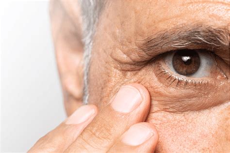 Glaucoma: Causes, Symptoms, Treatment & Prevention Guide
