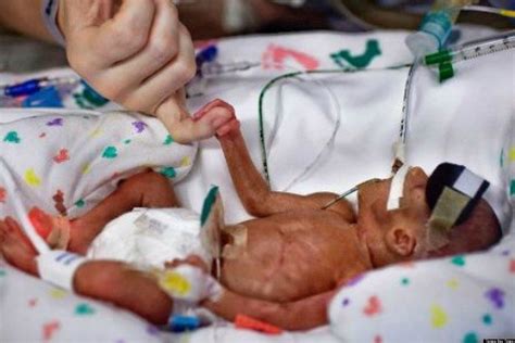 Kelley Benham, Tampa Bay Times Journalist, Shares Micro-Preemie ...