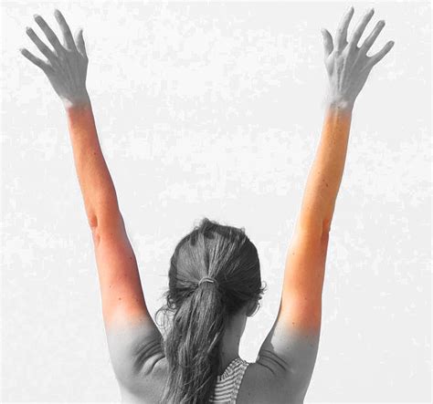 Arms - Full - Laser Hair Removal NYC