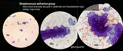 Streptococcus Salivarius