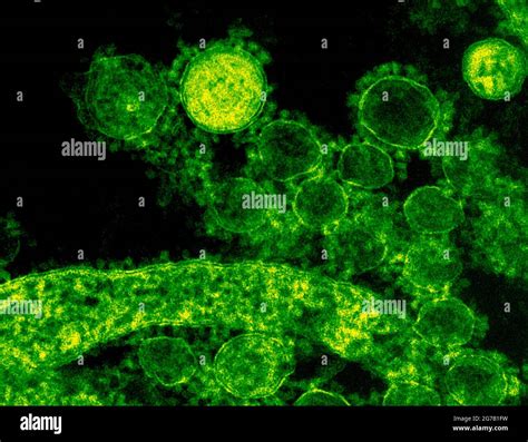 Electron Microscope 的图像结果