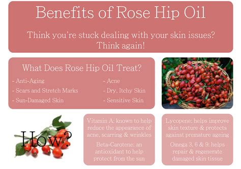 Easy Infographic: The Benefits of Rose Hip Oil | Rosehip oil, Oils ...