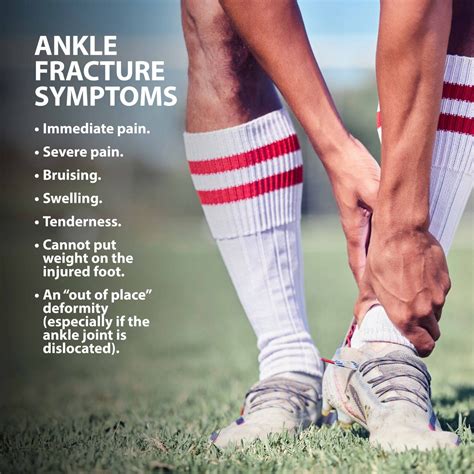 Fractured ankle symptoms – Artofit