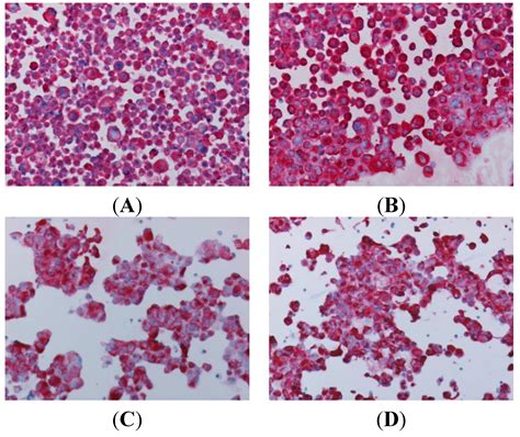 In Vitro Efficient Expansion of Tumor Cells Deriving from Different ...