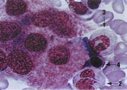 Image result for 破骨细胞
