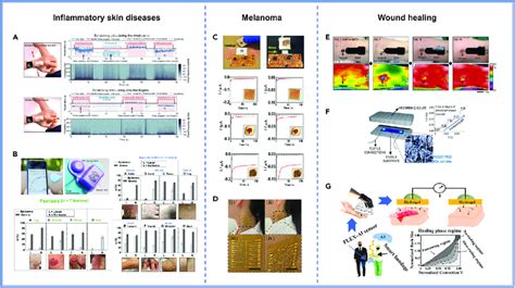 Wearable Sensor 的图像结果