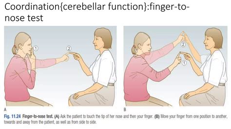 neurological examination by Suleiman Suleiman | PDF