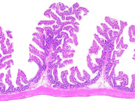 Image result for Jejunum Microscope