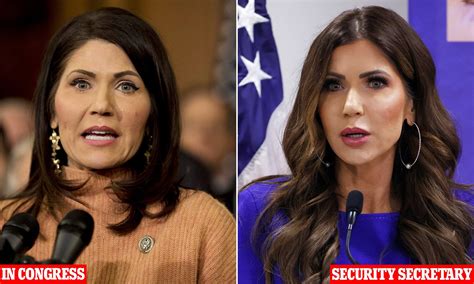 Plastic surgeons reveal what could be behind ICE Barbie Kristi Noem's ...