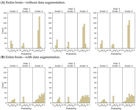 AI-Based Glioma Grading for a Trustworthy Diagnosis: An Analytical ...