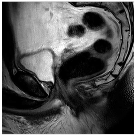 Contemporary Review of Multimodality Imaging of the Prostate Gland