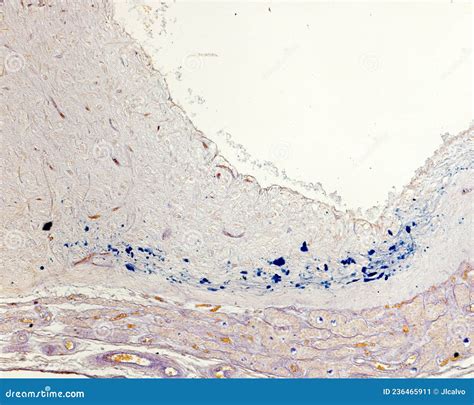 Infundibular Stalk Histology