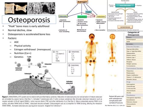 Nmt631 scintigraphy in common bone diseases | PPTX