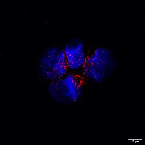 PEX14 antibody (10594-1-AP) | Proteintech