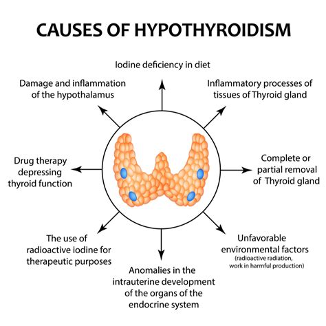 Complete Thyroid Health Guide: Causes, Prevention, Diet, Treatment ...